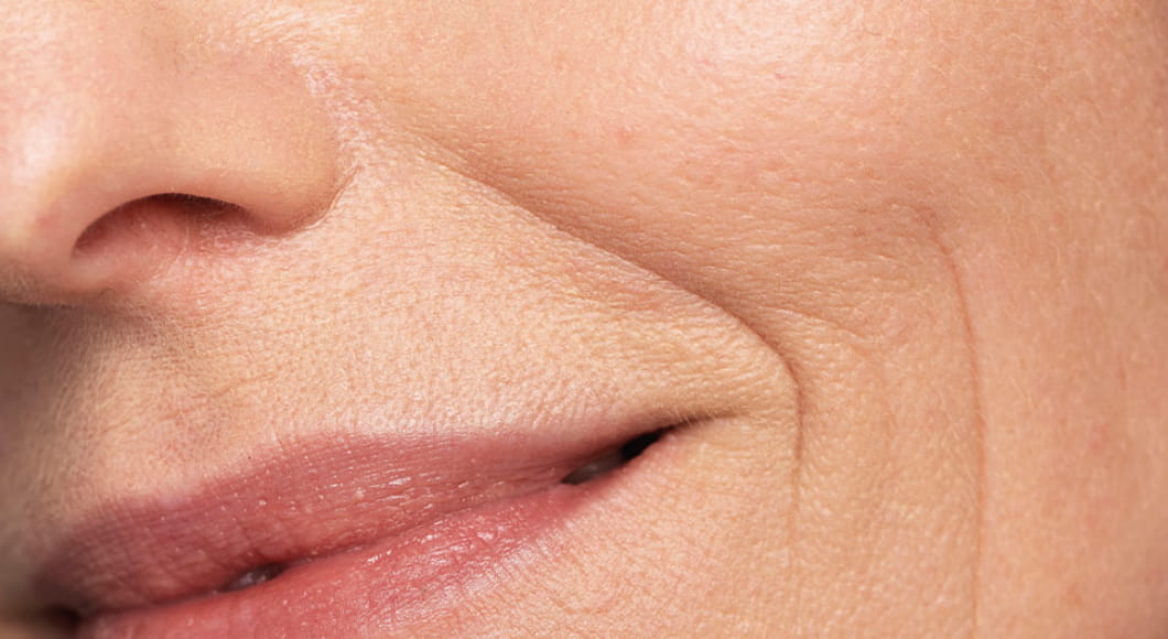 v_skin