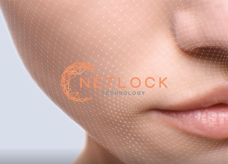 Netlock technology